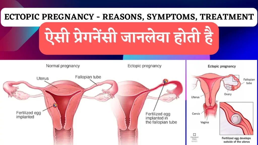 Pregnancy Tips and Advice - Pregnancy Hindi